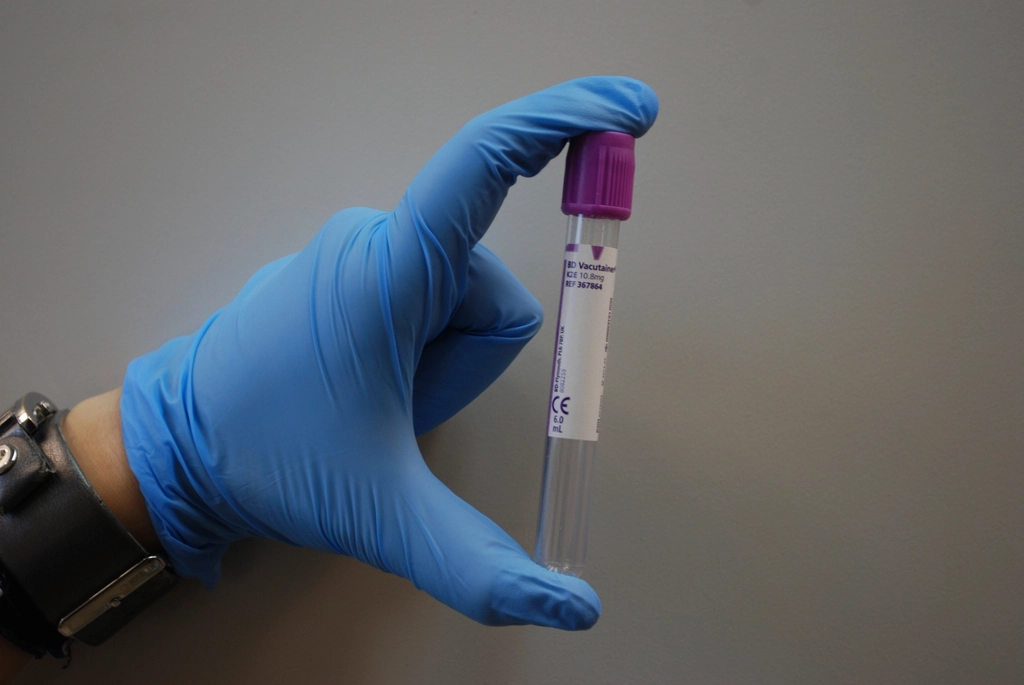 A blue-gloved hand holding a single labelled laboratory sample collection tube against a clean neutral background, evoking discreet, professional diagnostic testing.